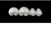 Cod.E3LOWER LEFT: 15x  posterior hollow wax veneers-bridges, SMALL, (34-37), with precarved occlusion to Cod.E3UPPER LEFT, and compatible to Cod.S3LOWER LEFT (solid), (34-37)